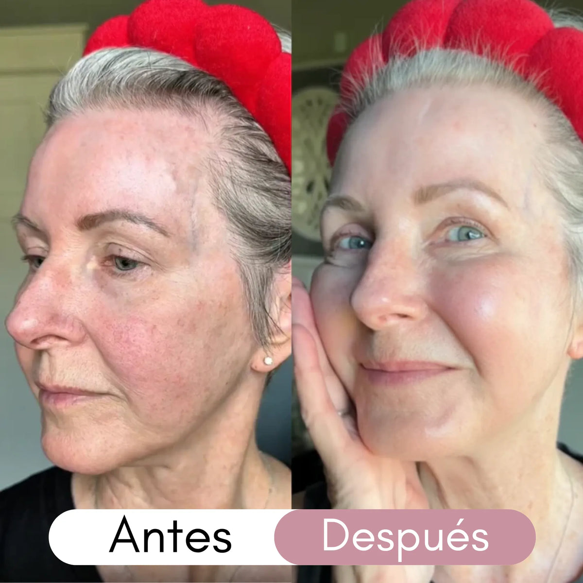 Mascarilla de Colágeno Vitanova